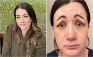 ВИДЕО | Неуспешен ботокс ѝ го направил лицето како да е од кошмарите: „Го исплашив мојот свршеник“