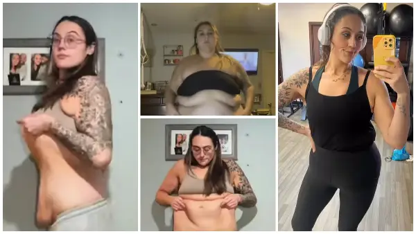 Катарина ослабела 114 килограми со операција на желудник, но по 2 години е разочарана: „Сè уште го мразам своето тело“