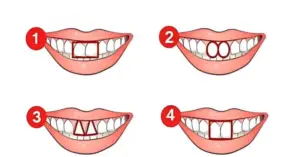 Што кажуваат забите за вас? Насмевнете се и откријте дали сте смирен дипломат или друштвена личност