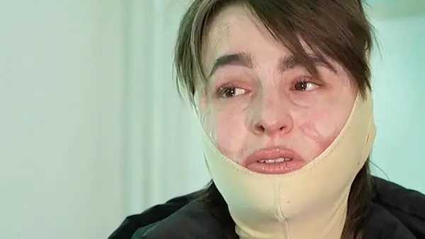 (Видео) Исповед на преживеана од „Пулс“: По комата започна борбата за живот, а денес сфаќам дека ништо не вреди ако не си здрав