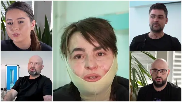 Една година од трагедијата во Кочани: Сведоштва на преживеаните една година по пожарот во дискотеката „Пулс“