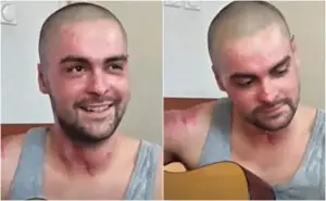 ВИДЕО | Тешко повредениот гитарист на „ДНК“ повторно запеа, изгорениците се на телото, но и на срцето