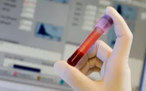 Обичен тест на крвта може да открие тумор на мозокот, научниците дојдоа до големо откритие