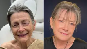 ВИДЕО | Естетски хирург помлади жена за 30 години, луѓето шокирани од резултатот на зафатот!