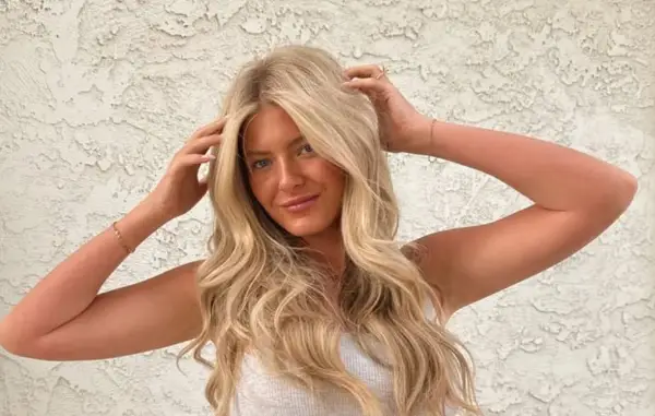 Млада инфлуенсерка потрошила 12.000 евра на естетски операции: Тоа ми беше желба од малечка (ФОТО)