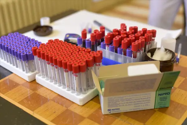 Лицата со крвна група Б имаат зголемен ризик од дијабетес тип 2 