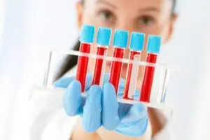 Нова студија: Луѓето со крвна група Б се повеќе изложени на ризик од дијабетес тип 2