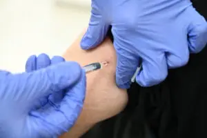 Првиот пациент во Русија прими персонализирана вакцина против рак