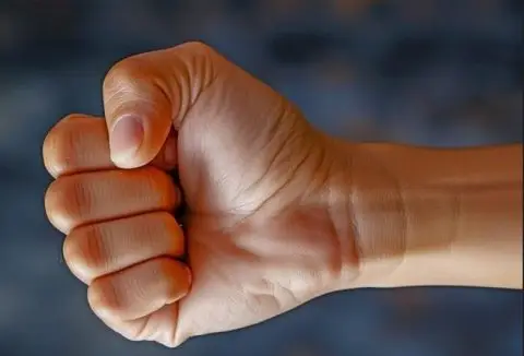 Драма во зграда во Скопје: Маж нападнат со тврд предмет од својот сосед