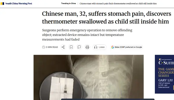 Човек во Кина живеел со живин термометар во цревата 20 години