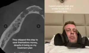 ФОТО | Британец отишол во Турција по „холивудска насмевка“ – се вратил без ниеден заб