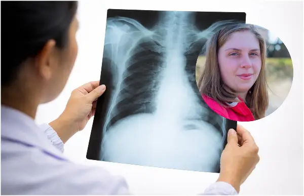 Девојка од 22 години добила рак на бели дробови буквално „преку ноќ“: Дали оваа навика е виновна за нејзината тешка состојба?