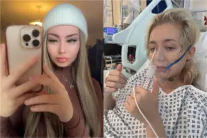 ФОТО | На 22-годишна Британка ѝ даваат 18 месеци живот откако „вејпала“ од 15 години