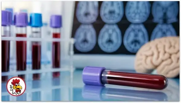 Нов тест на крвта открива Алцхајмерова болест со точност до 97 проценти