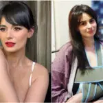 Драгана Левенска со повредена рака по судир со тротинет: „Се разбравме, но сите да внимаваме“