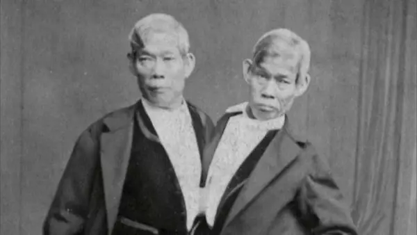 Првите сијамски близнаци имале сопруги и многу деца! Спиеле во посебен кревет (ВИДЕО)