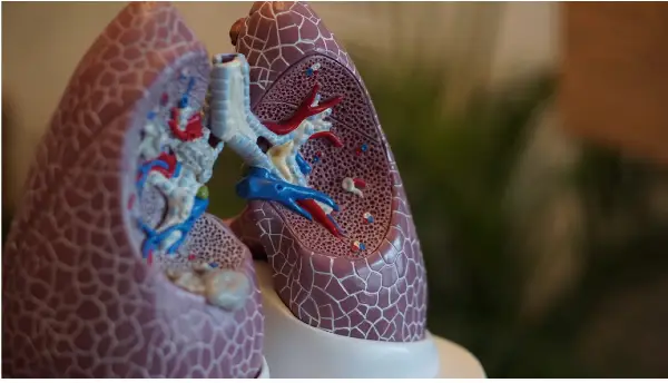 Лекарите во Русија идентификуваат нова форма на белодробно оштетување