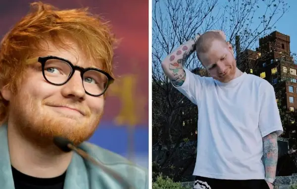 Ед Ширан си ја избричи главата и ја откри причината: Се борам со херпес, тоа никому не би го посакал 