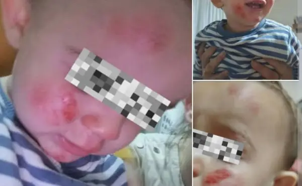 ФОТО: Хаос на градилиште во центарот на Скопје, пропадна дел од улицата - падна бандера, оштети возила, граѓаните револтирани
