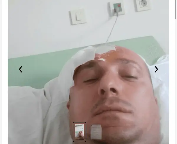 Тони не бара чудо, бара шанса: Потребна е итна поддршка за операција на мозок закажана за 29-ти овој месец