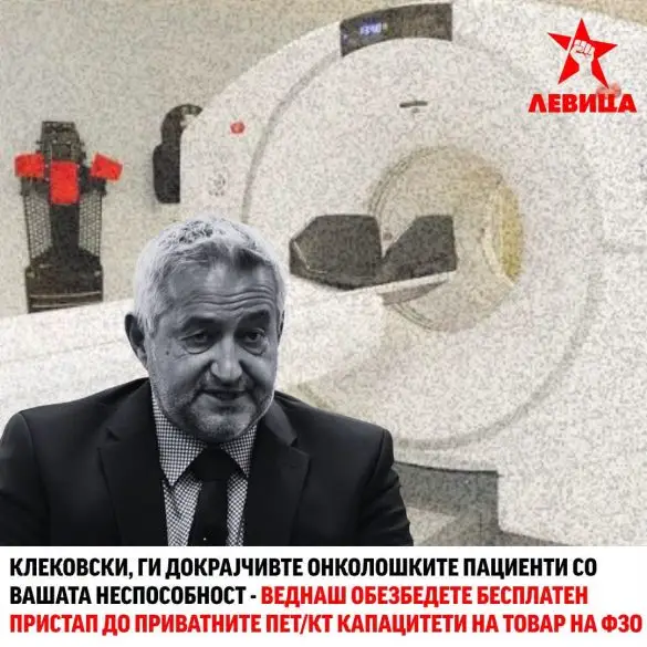 Левица: Клековски да обезбеди бесплатен пристап до приватните ПЕТ скенови за онколошките пациенти