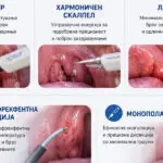 Совети од Клиника „Жан Митрев“: Современи техники за тонзилектомија