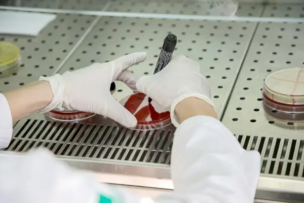 Опасен вирус повторно регистриран: Сопруга на дипломат заразена, сопругот во изолација