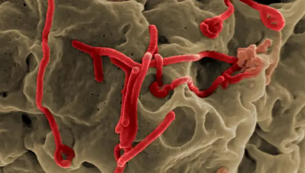 Бројот на случаи на ебола во Конго надмина 10.000, половина од нив починаа