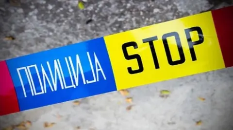 Жена од Скопје погодена со воздушна пушка, ја ранил нејзиниот син!