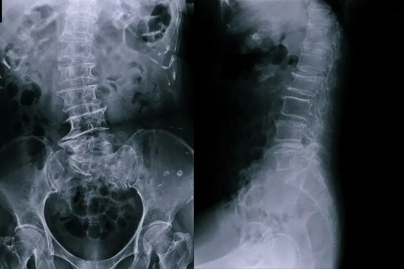 Се жалел на страшни болки во стомакот- докторите занемеле кога виделе што има внатре 