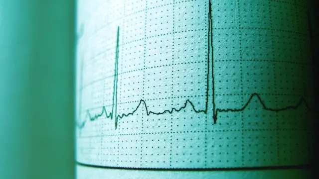 Доктор: 90 проценти од срцевите удари започнуваат со една утринска навика