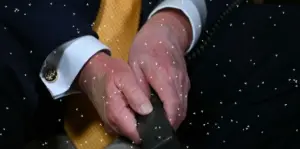 Трамп: Земам повисоки дози аспирин од препорачаните, затоа имам модринки