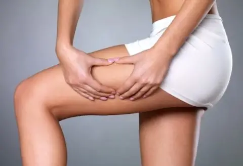 Целулитот исчезнува за час: 5 трикови за најзатегнатите нозе во градот – ова масло прави чуда