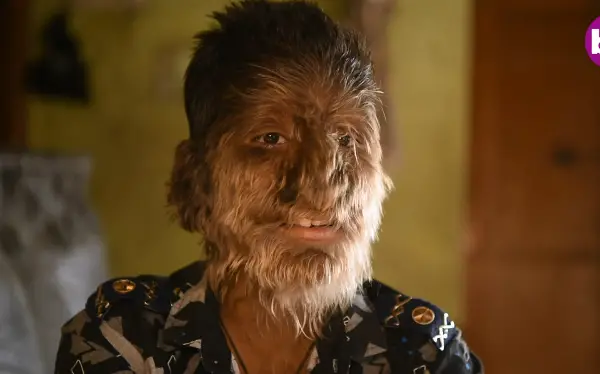 Највлакнестиот маж во светот: Официјално е дел од Гинис (ВИДЕО)