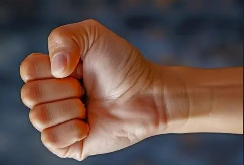 Битола: Внук крвнички ја претепал баба си: Жената со тешки повреди итно пренесена во болница