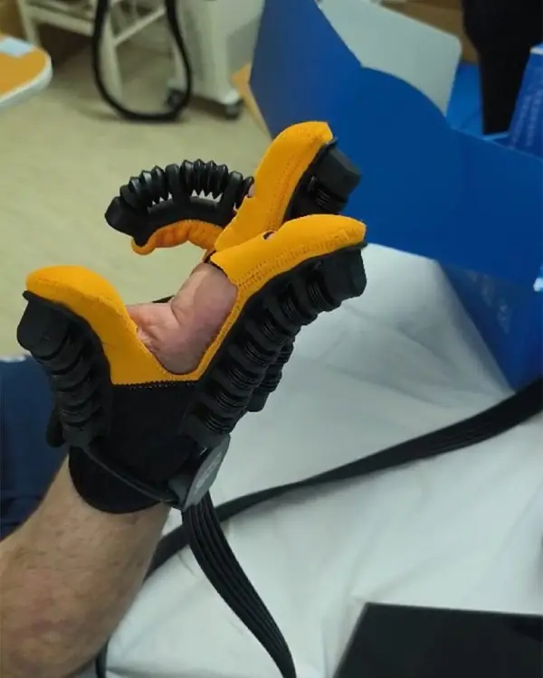 Фондацијата „Заедно за едно“ донираше на кочанската болница 90 комплети ракавици за пасивна рехабилитација