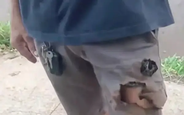 Го нападнале две агресивни кучиња- се спасил кога му експлодира телефонот (ВИДЕО)