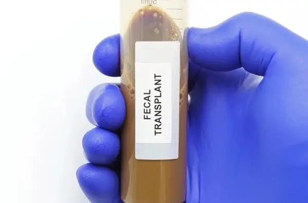 Шведска болница бара донатори на фекалии