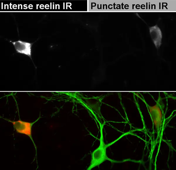 Еден протеин може да не спаси од депресија – цревата и мозокот тесно поврзани